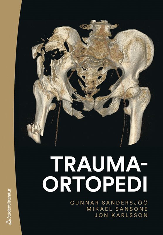 Traumaortopedi